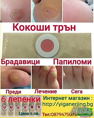 Кокоши трън, твърди мазоли, брадавици