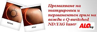 Премахване на татуировки и перманентен грим с лазер