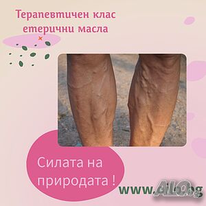разширени вени на краката „Тежки крака? Отоци? Болка?