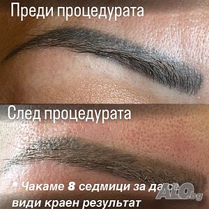 image_12
