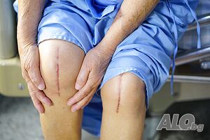 Рехабилитация и Физиотерапия след Смяна на Става