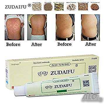 ZUDAIFU крем за псориазис, екземи, дерматити, гъбички и др | Здравословни и билкови продукти | Пловдив